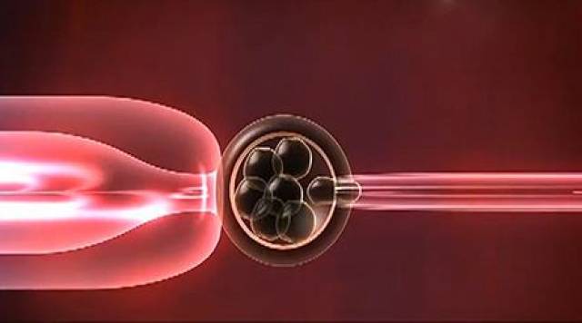 体外受精 IVF-ET